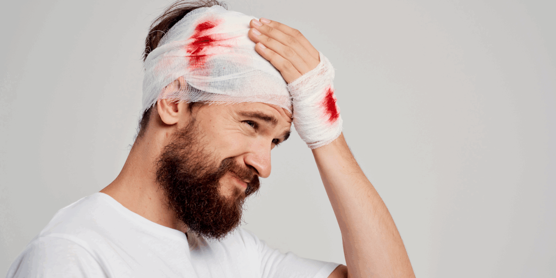 head injuries in california