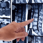 spine scan and injuries