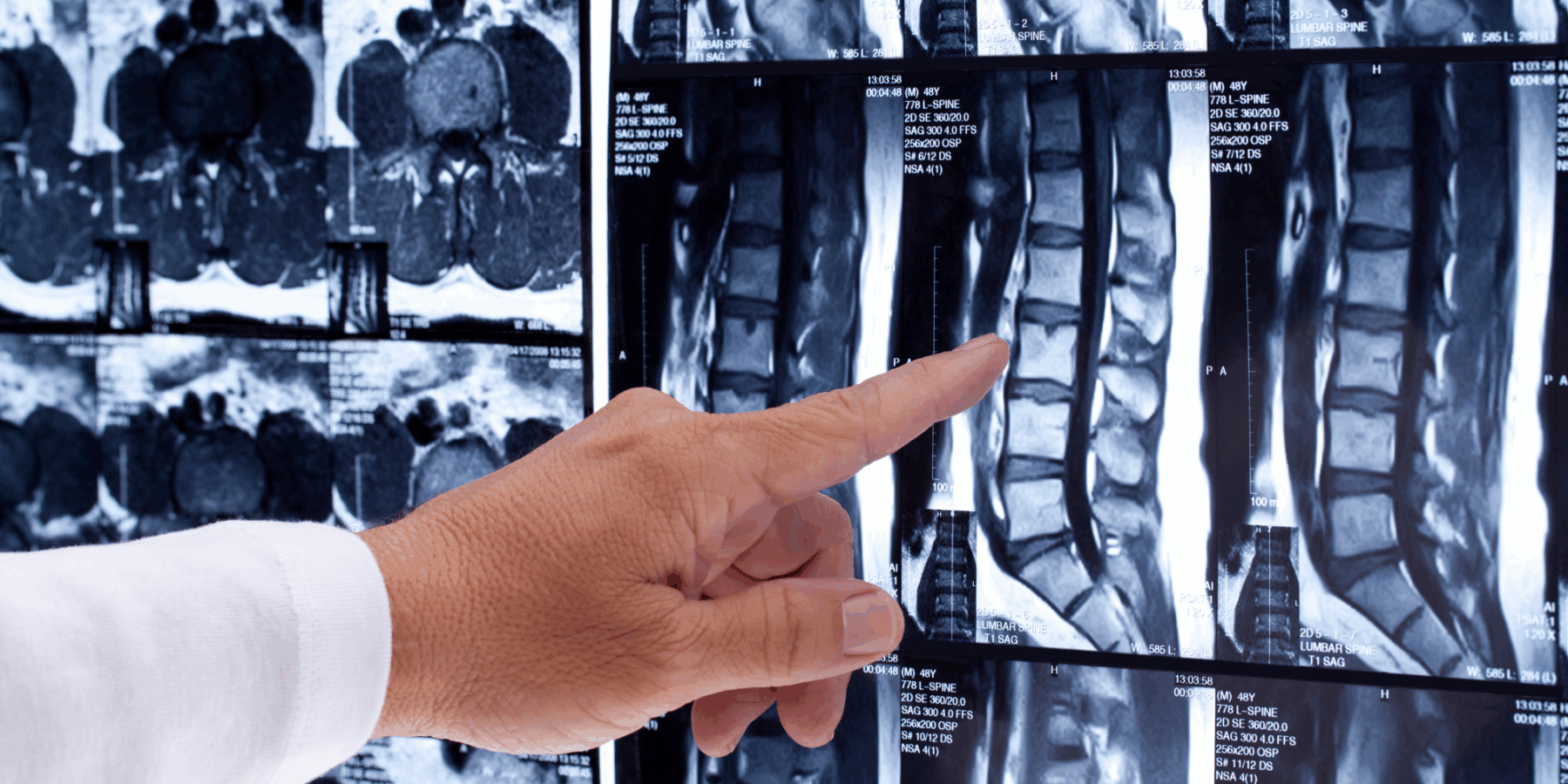 spine scan and injuries